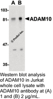 Anti-ADAM10 Rabbit Polyclonal Antibody
