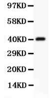 Anti-CD3 Epsilon Polyclonal Antibody