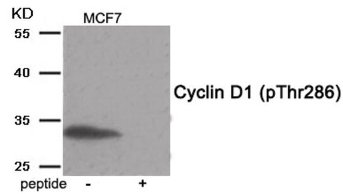 Cyclin D1 (phospho Thr286) Polyclonal Antibody 0.1mg