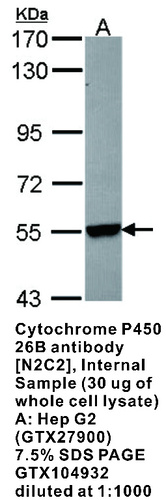 Rabbit Polyclonal antibody to Cytochrome P450 26B