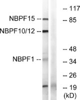 Anti-NBPF1 + 9 + 10 + 12 + 14 + 15 + 16 + 20 Rabbit Polyclonal Antibody