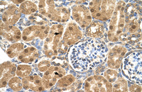 Anti-P4HB Rabbit Polyclonal Antibody