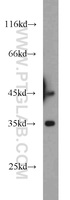 Anti-DTNBP1 Rabbit Polyclonal Antibody