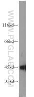 Anti-ACTA2 Rabbit Polyclonal Antibody