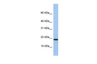 Anti-C1D Rabbit Polyclonal Antibody