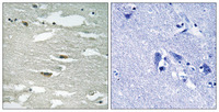 Anti-ILK Rabbit Polyclonal Antibody