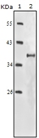 Anti-IGF1R Mouse Monoclonal Antibody [clone: 3C8B1]