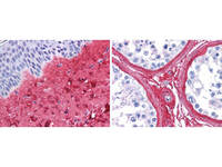 Anti-COL3A1 Rabbit Polyclonal Antibody (HRP)