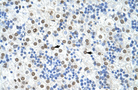 Anti-HNRNPA1 Rabbit Polyclonal Antibody