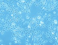 Human Bronchial Epithelial Cells (HBEpC), PromoCell
