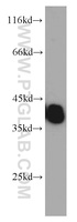 Anti-TPM3 Rabbit Polyclonal Antibody