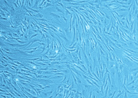 Human Aortic Adventitial Fibroblasts (HAoAF), PromoCell