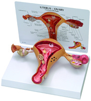GPI Anatomicals® Basic Uterus Model