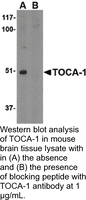 Anti-TOCA-1 Rabbit Polyclonal Antibody