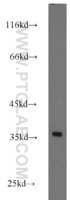 Anti-RPS3A Rabbit Polyclonal Antibody