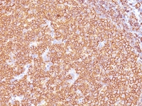 Anti-CD20 Mouse Monoclonal Antibody [Clone: SPM618]