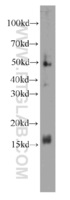 Anti-FKBP2 Mouse Monoclonal Antibody [clone: 2H7E8]