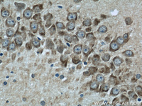 Anti-DLG4 Rabbit Polyclonal Antibody