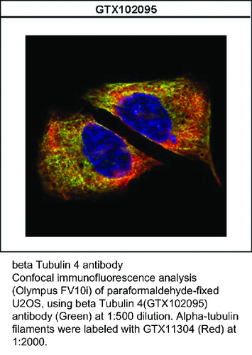 Rabbit Polyclonal antibody to beta Tubulin 4 (tubulin, beta 4)
