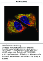 Anti-TUBB4 Rabbit Polyclonal Antibody