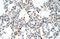 Anti-DLX5 Rabbit Polyclonal Antibody