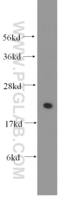 Anti-RPL13 Rabbit Polyclonal Antibody