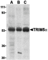 Anti-TRIM5 Rabbit Polyclonal Antibody