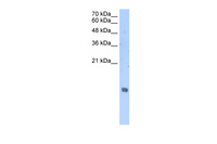 Anti-HIST2H2AA3 Rabbit Polyclonal Antibody