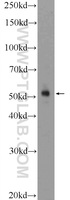 Anti-CCNE1 Rabbit Polyclonal Antibody