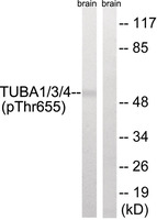 Anti-TUBA1A/TUBA1B/TUBA1C Rabbit Polyclonal Antibody