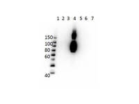 Anti-HbBc Mouse Monoclonal Antibody [Clone: 15C2.C11.F2.G11]