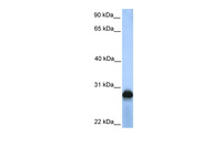 Anti-SIGLEC12 Rabbit Polyclonal Antibody