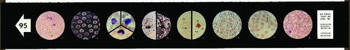 Human Blood Microslides