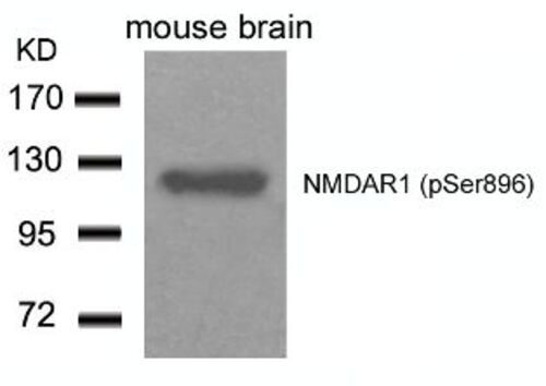 NMDAR1 (phospho Ser896) Antibody