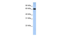 Anti-SLC22A13 Rabbit Polyclonal Antibody