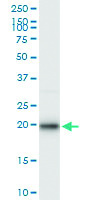 Anti-EIF5A2 Polyclonal Antibody Pair
