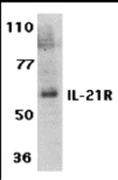 Anti-IL21R Rabbit Polyclonal Antibody