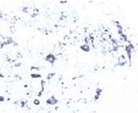 Anti-the Tyrosine Kinase Receptor B Rabbit Polyclonal Antibody