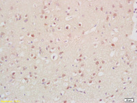 Anti-CCNG2 Rabbit Polyclonal Antibody