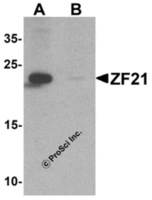 Anti-ZFYVE21 Rabbit Polyclonal Antibody