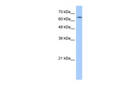 Anti-SLC22A11 Rabbit Polyclonal Antibody