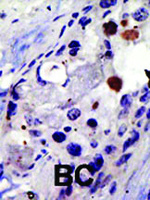Anti-PSMD4 Rabbit Polyclonal Antibody