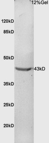 CDK9 THR186 Antibody