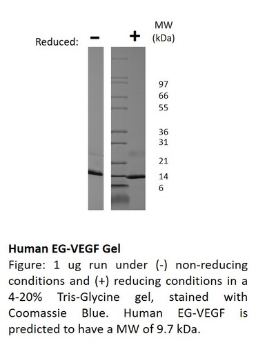 Human Recombinant EGVEGF (from <i>E. coli</i>)