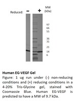 Human Recombinant EGVEGF (from E. coli)