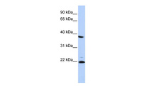 Anti-PSMB2 Rabbit Polyclonal Antibody