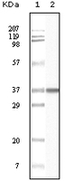 Anti-BLK Mouse Monoclonal Antibody [clone: 9D10B7H6 / 9D10A8F8]
