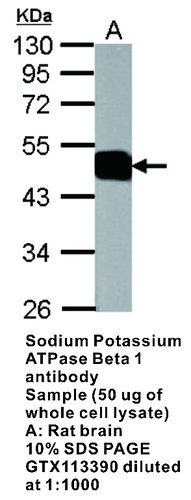 Rabbit Polyclonal antibody to Sodium Potassium ATPase Beta 1