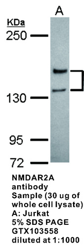 Rabbit Polyclonal antibody to NMDAR2A (glutamate receptor, ionotropic, N-methyl D-aspartate 2A)