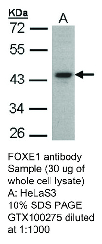 Rabbit Polyclonal antibody to FOXE1 (forkhead box E1 (thyroid transcription factor 2))